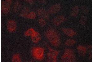 ABIN6268913 staining lovo cells by ICC/IF.