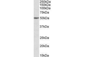 Western blot analysis: MON1A antibody staining of Jurkat lysate at 2 µg/ml (35µg protein in RIPA buffer). (MON1A Antikörper  (Internal Region))