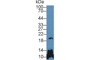 Western blot analysis of Mouse Cerebrum lysate, using Human GH Antibody (5 µg/ml) and HRP-conjugated Goat Anti-Rabbit antibody ( (Growth Hormone 1 Antikörper  (AA 28-217))