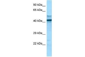 Western Blotting (WB) image for anti-Fc Fragment of IgG, High Affinity Ia, Receptor (CD64) (FCGR1A) (C-Term) antibody (ABIN2789678)