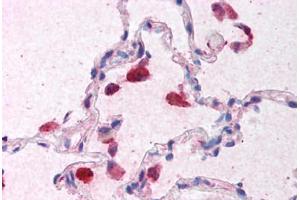 Human Lung (formalin-fixed, paraffin-embedded) stained with IFNB1 antibody ABIN213936 at 5 ug/ml followed by biotinylated goat anti-rabbit IgG secondary antibody ABIN481713, alkaline phosphatase-streptavidin and chromogen. (IFNB1 Antikörper  (Internal Region))