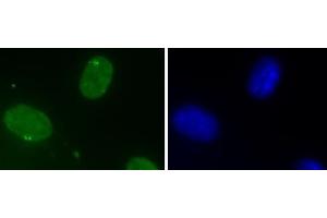 DHX9 antibody (mAb) (Clone 8E3) tested by Immunofluorescence. (DHX9 Antikörper  (N-Term))