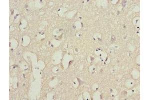 Immunohistochemistry of paraffin-embedded human brain tissue using ABIN7163171 at dilution of 1:100 (PIK3R3 Antikörper  (Regulatory Subunit Gamma))