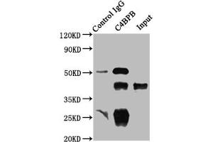 Immunoprecipitating C4BPB in HepG2 whole cell lysate Lane 1: Rabbit control IgG instead of ABIN7146168 in HepG2 whole cell lysate. (C4BPB Antikörper  (AA 18-252))