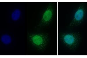 Detection of LSR in Human HepG2 cell using Polyclonal Antibody to Lipolysis Stimulated Lipoprotein Receptor (LSR) (LSR Antikörper  (AA 35-205))