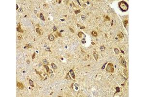 Immunohistochemistry of paraffin-embedded Mouse brain using SMAD9 Polyclonal Antibody at dilution of 1:100 (40x lens). (SMAD9 Antikörper)