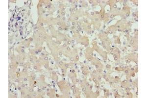 Immunohistochemistry of paraffin-embedded human liver tissue using ABIN7176493 at dilution of 1:100 (ZNF643 Antikörper  (AA 15-310))