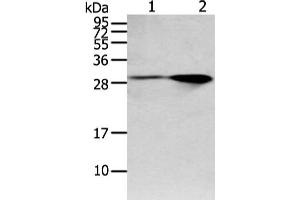 Gel: 12 % SDS-PAGE, Lysate: 40 μg, Lane 1-2: Mouse brain and human fetal brain tissue, Primary antibody: ABIN7128020(SPIN4 Antibody) at dilution 1/200 dilution, Secondary antibody: Goat anti rabbit IgG at 1/8000 dilution, Exposure time: 1 minute (SPIN4 Antikörper)