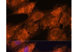 Immunofluorescence analysis of C6 cells using IPO4 Polyclonal Antibody at dilution of 1:100. (Importin 4 Antikörper)