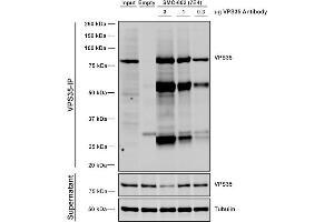 Immunoprecipitation analysis using Mouse Anti-VPS35 Monoclonal Antibody, Clone 7E4 (ABIN6932912). (VPS35 Antikörper  (Atto 594))
