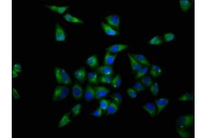 Immunofluorescence staining of Hela cells with ABIN7161665 at 1:200, counter-stained with DAPI. (OPRL1 Antikörper  (AA 323-370))