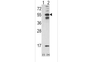 Western blot analysis of CAMK2A using rabbit polyclonal C using 293 cell lysates (2 ug/lane) either nontransfected (Lane 1) or transiently transfected with the CAMK2A gene (Lane 2). (CAMK2A Antikörper  (C-Term))