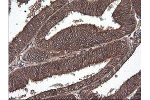 Image no. 2 for anti-Cancer/testis Antigen 1B (CTAG1B) antibody (ABIN1499906) (CTAG1B Antikörper)