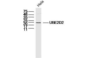 UBE2D2 Antikörper  (AA 31-130)