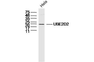 Hela lysates probed with UBE2D2 Polyclonal Antibody, Unconjugated  at 1:300 dilution and 4˚C overnight incubation.