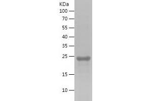 Western Blotting (WB) image for Spermatogenesis Associated 22 (SPATA22) (AA 1-200) protein (His tag) (ABIN7282973) (SPATA22 Protein (AA 1-200) (His tag))