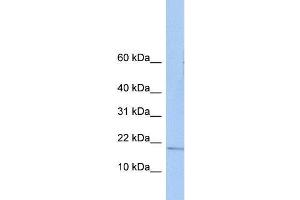 Human Placenta; WB Suggested Anti-ZNHIT3 Antibody Titration: 0. (ZNHIT3 Antikörper  (N-Term))