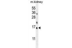 Western Blotting (WB) image for anti-Harakiri, BCL2 Interacting Protein (Contains Only BH3 Domain) (HRK) (BH3 Domain) antibody (ABIN2997154) (HRK Antikörper  (BH3 Domain))