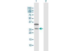 Western Blot analysis of CD79B expression in transfected 293T cell line by CD79B MaxPab polyclonal antibody. (CD79b Antikörper  (AA 1-229))