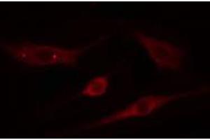 ABIN6274811 staining NIH-3T3 cells by IF/ICC. (ADAMTS18 Antikörper  (C-Term))