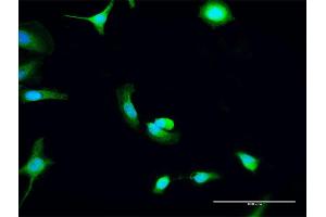 Immunofluorescence of purified MaxPab antibody to C8orf33 on HeLa cell. (C8orf33 Antikörper  (AA 1-229))