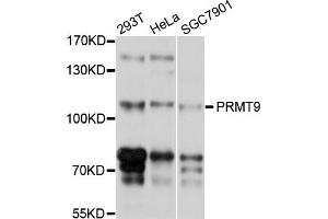 Western blot analysis of extracts of various cell lines, using PRMT9 antibody (ABIN4904870) at 1:1000 dilution. (FBXO11 Antikörper)