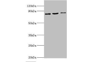Western blot All lanes: SATB1 antibody at 2 μg/mL Lane 1: Mouse brain tissue Lane 2: 293T whole cell lysate Lane 3: Jurkat whole cell lysate Secondary Goat polyclonal to rabbit IgG at 1/10000 dilution Predicted band size: 86, 90 kDa Observed band size: 86 kDa (SATB1 Antikörper  (AA 484-763))
