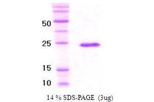 SDS-PAGE (SDS) image for Von Hippel-Lindau Tumor Suppressor, E3 Ubiquitin Protein Ligase (VHL) (AA 1-154) protein (His tag) (ABIN666848)