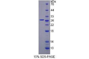 SDS-PAGE analysis of Mouse CTSF Protein.