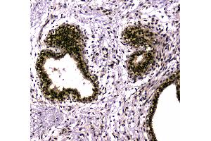 Immunohistochemistry (IHC) image for anti-SUMO1 Activating Enzyme Subunit 2 (UBA2) (AA 449-564) antibody (ABIN5692937)