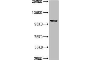 Western Blot Positive WB detected in: U87 whole cell lysate All lanes: AMPD2 antibody at 3 μg/mL Secondary Goat polyclonal to rabbit IgG at 1/50000 dilution Predicted band size: 101, 93, 89 kDa Observed band size: 101 kDa (AMPD2 Antikörper  (AA 1-129))