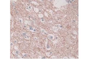 DAB staining on IHC-P; Samples:Human Brain Tissue) (PAI1 Antikörper  (AA 25-402))