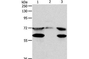 Western Blot analysis of Hela cell, Mouse testis tissue and Jurkat cell using CCDC99 Polyclonal Antibody at dilution of 1:400 (CCDC99 Antikörper)