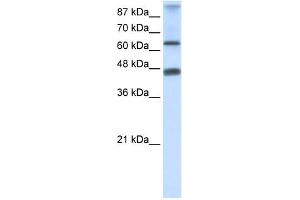 WB Suggested Anti-ZNF79 Antibody Titration:  0. (ZNF79 Antikörper  (N-Term))