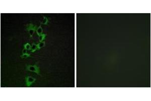 Immunofluorescence analysis of HepG2 cells, using HER4 (Ab-1284) Antibody. (ERBB4 Antikörper  (AA 1250-1299))