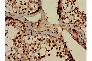 Immunohistochemistry of paraffin-embedded human testis tissue using ABIN7164998 at dilution of 1:100 (POT1 Antikörper  (AA 250-432))