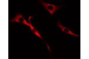ABIN6272650 staining Hela cells by IF/ICC. (CDC37L1 Antikörper  (Internal Region))