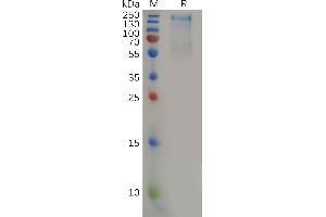 Human CD45 Protein, His Tag on SDS-PAGE under reducing condition.