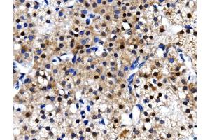 IHC analysis of TBP-1/PSMC3 using anti-TBP-1/PSMC3 antibody (ABIN7599393).