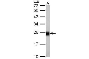 Western Blotting (WB) image for anti-NADH Dehydrogenase (Ubiquinone) Fe-S Protein 8, 23kDa (NADH-Coenzyme Q Reductase) (NDUFS8) (Center) antibody (ABIN2856948)