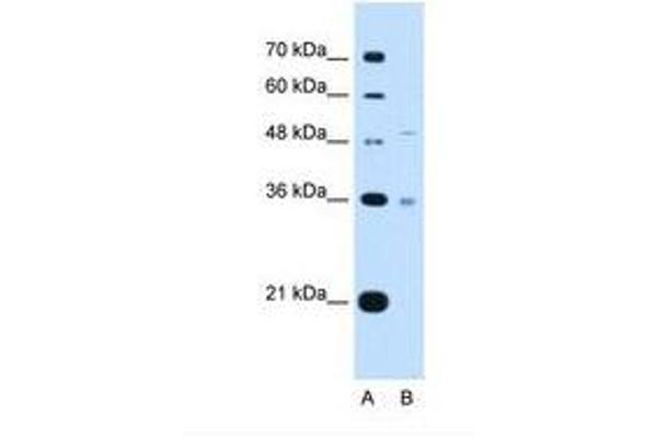 UST Antikörper  (AA 301-350)