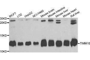 Western blot analysis of extracts of various cells, using TIMM10 antibody. (TIMM10 Antikörper)