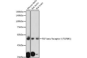 Western Blotting (WB) image for anti-Transforming Growth Factor, beta Receptor 1 (TGFBR1) (AA 34-124) antibody (ABIN6149081)