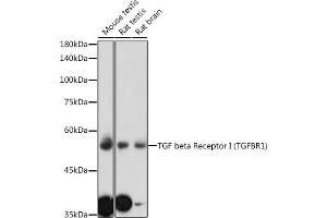 Western blot analysis of extracts of various cell lines, using TGF beta Receptor I (TGF beta Receptor I (TGFBR1)) antibody (ABIN6130733, ABIN6149081, ABIN6149082 and ABIN6213963) at 1:1000 dilution. (TGFBR1 Antikörper  (AA 34-124))