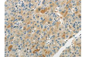 Immunohistochemistry (IHC) image for anti-Wingless-Type MMTV Integration Site Family, Member 2B (WNT2B) antibody (ABIN7193065)