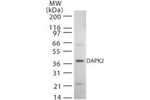 Western Blotting (WB) image for anti-Death-Associated Protein Kinase 2 (DAPK2) (AA 325-342) antibody (ABIN208411) (DAPK2 Antikörper  (AA 325-342))