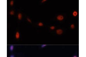 Immunofluorescence analysis of NIH/3T3 cells using p21 Polyclonal Antibody at dilution of 1:100. (p21 Antikörper)