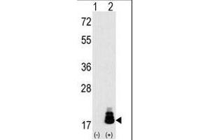 Western blot analysis of EIF4EBP1 (arrow) using rabbit polyclonal EIF4EBP1 Antibody (T69) (R).