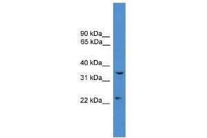 WB Suggested Anti-UCHL5 Antibody Titration: 0. (UCHL5 Antikörper  (Middle Region))