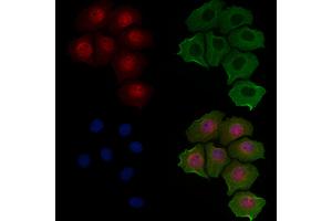 ABIN6257069 and ABIN6274978 staining Hela cells by IF/ICC. (CNOT4 Antikörper  (N-Term))